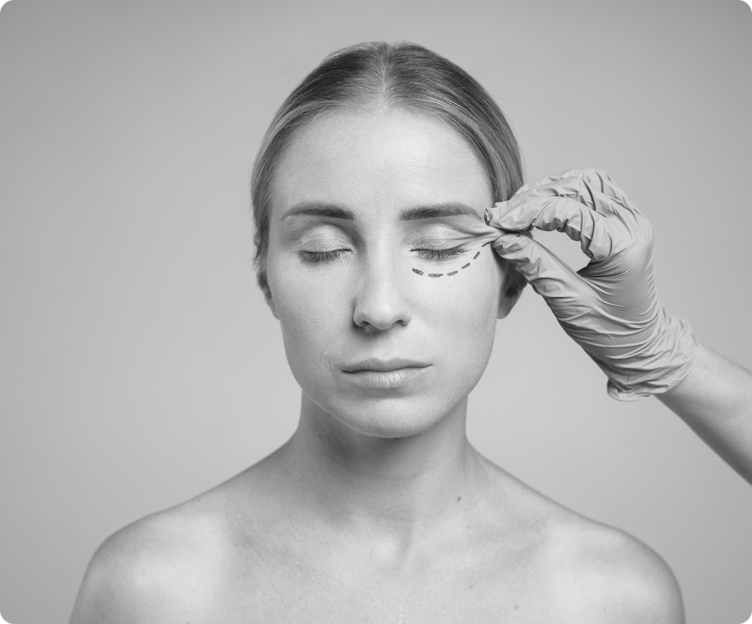 Пластика глаз